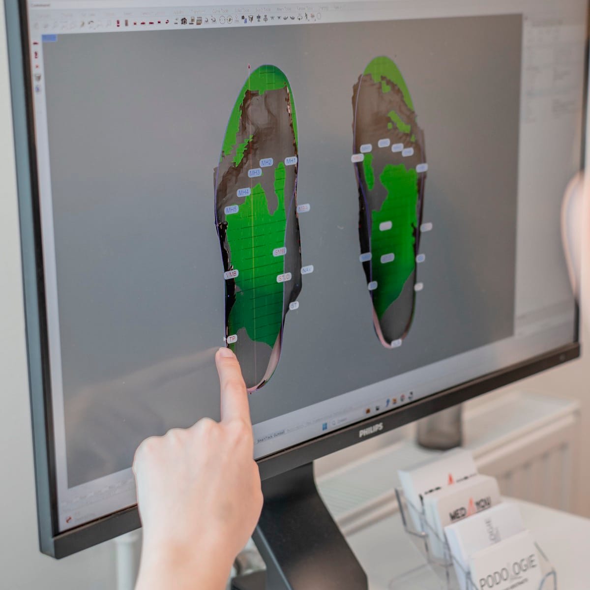 Hoe worden podologische zolen gemaakt? 2 3D-scan van de voeten met het digitale ontwerp van de podologische zolen