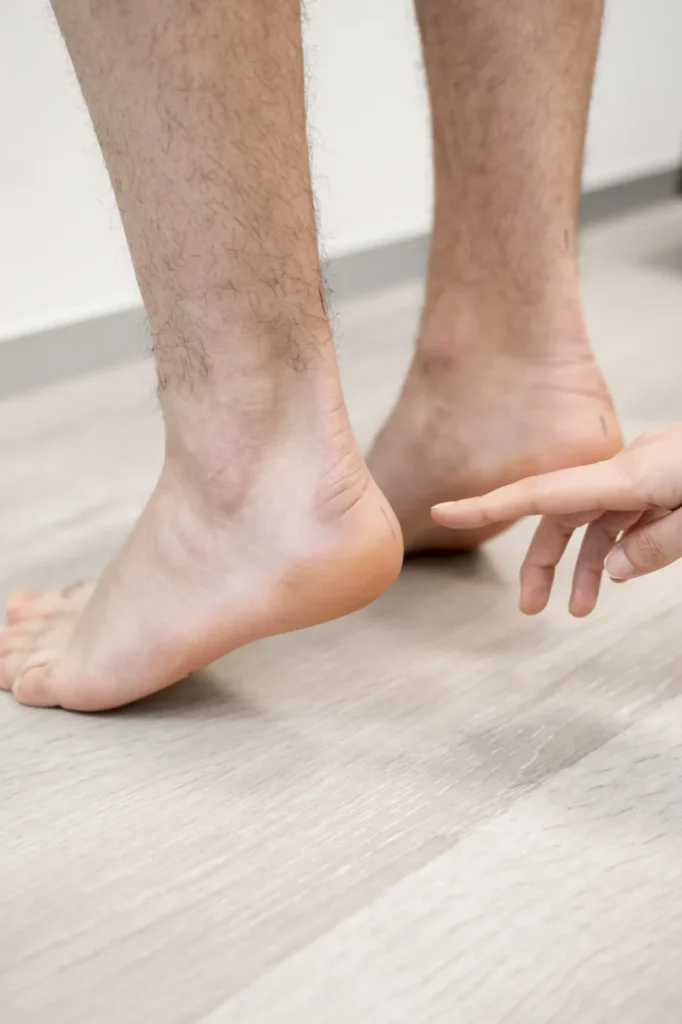 Podoloog voelt aan de onderkant van de hiel tijdens een onderzoek naar hielspoor
