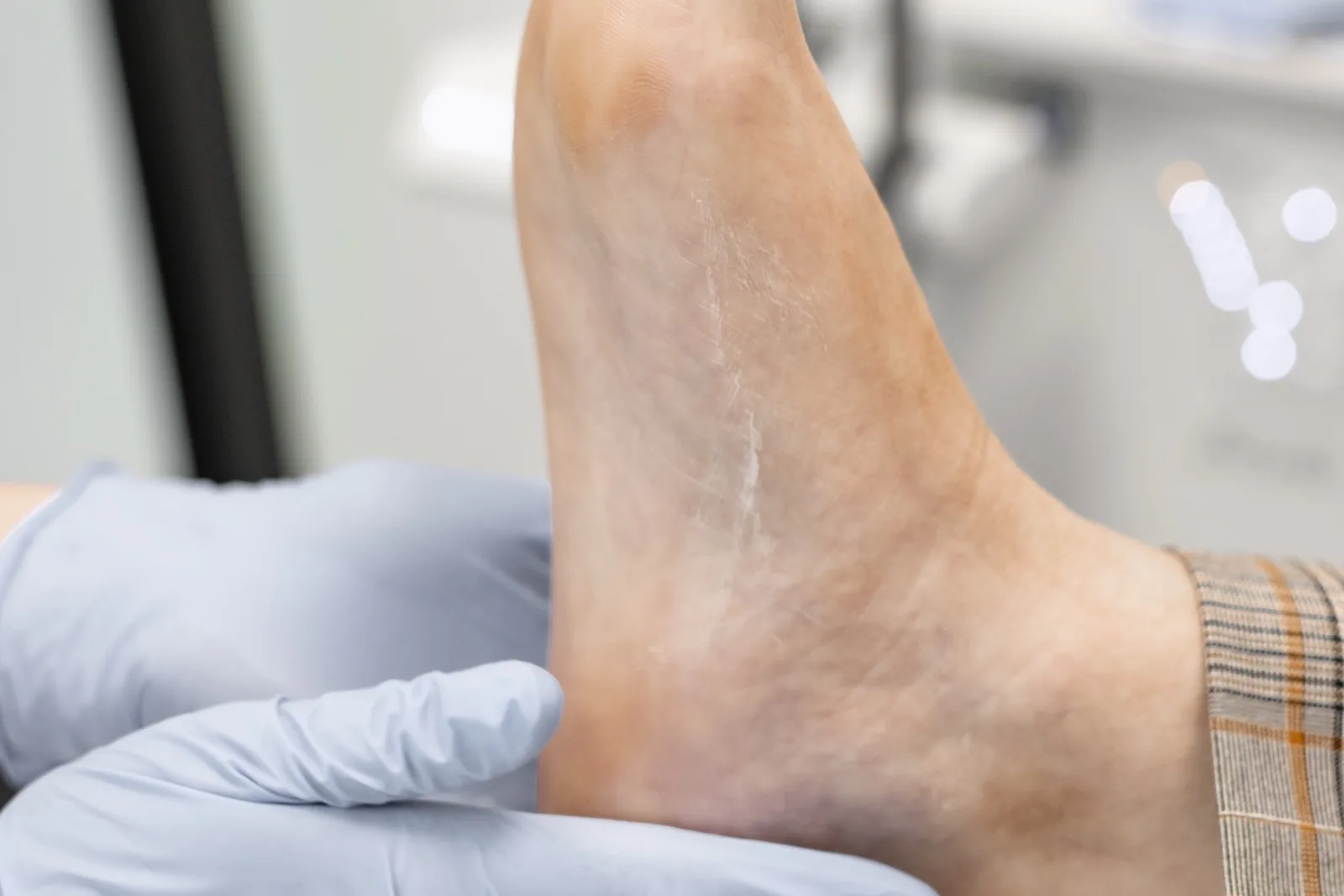 Pijn aan de voet: waar zit het en wat kan het zijn? 1 Handen in handschoenen houden een voet vast, met de binnenkant en de voetboog naar voren