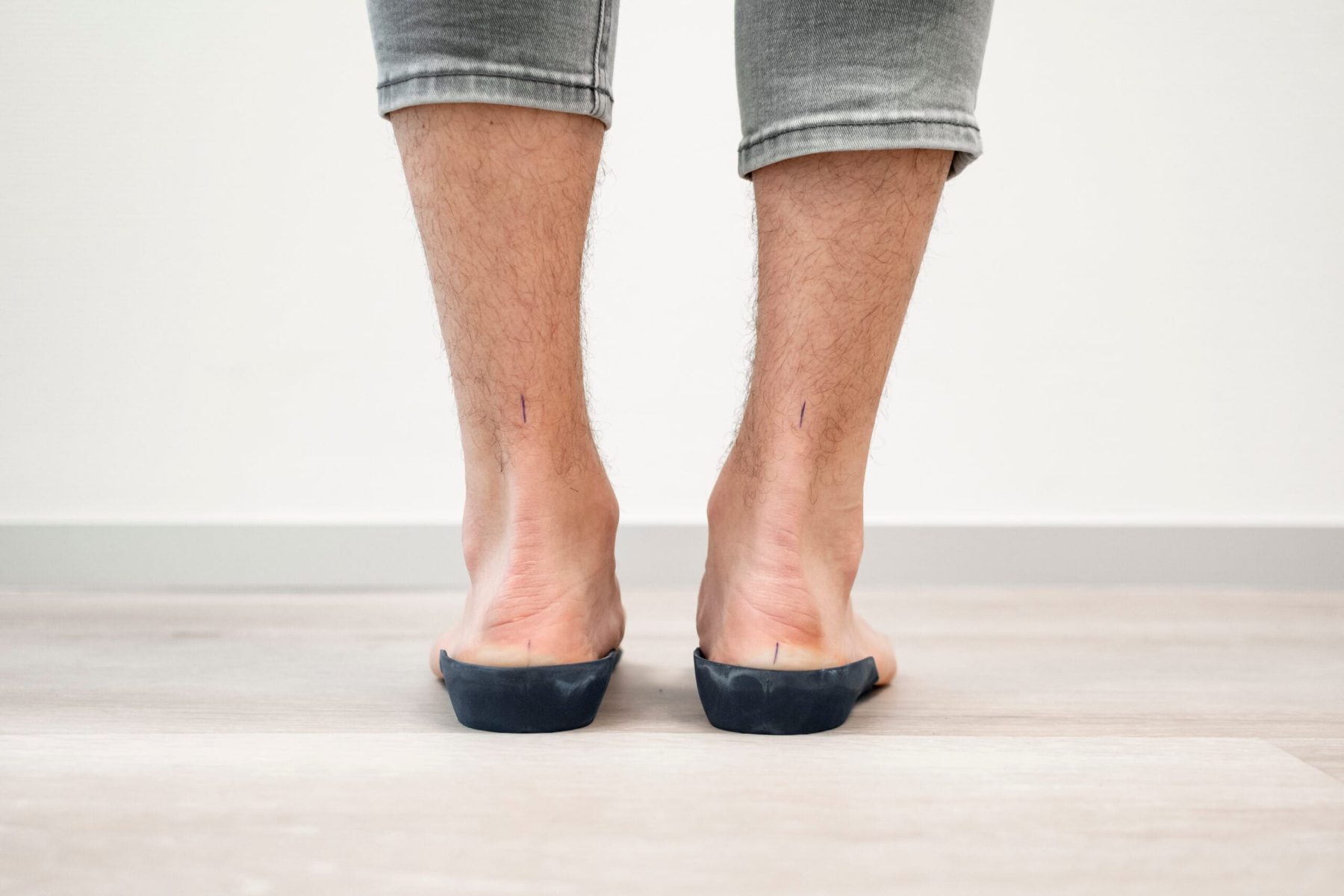 Platvoeten en Holvoeten